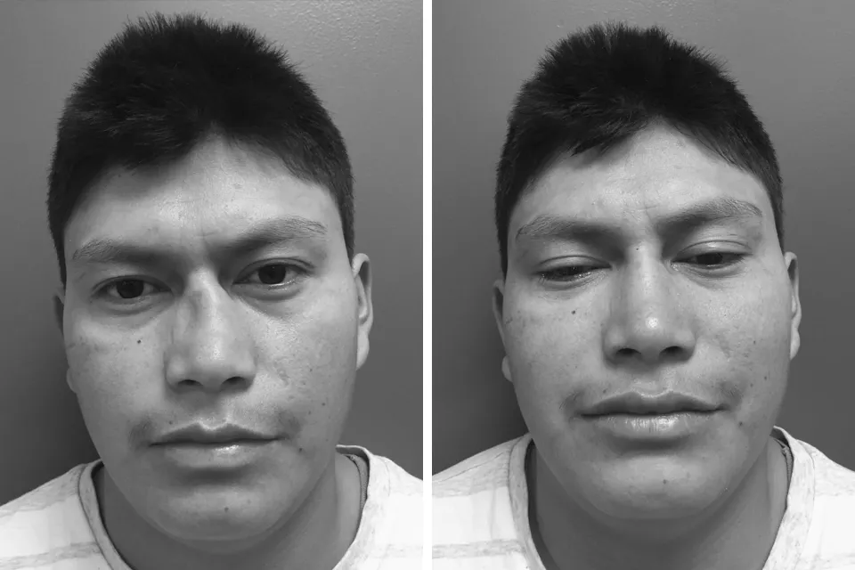 Facial Trauma & Scar Repair