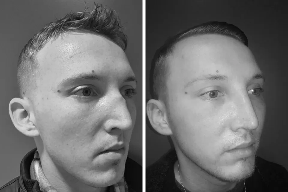 Facial Trauma & Scar Repair