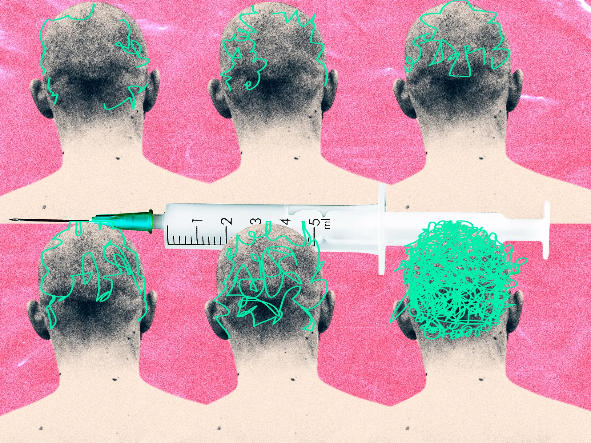 hair-plasma3
