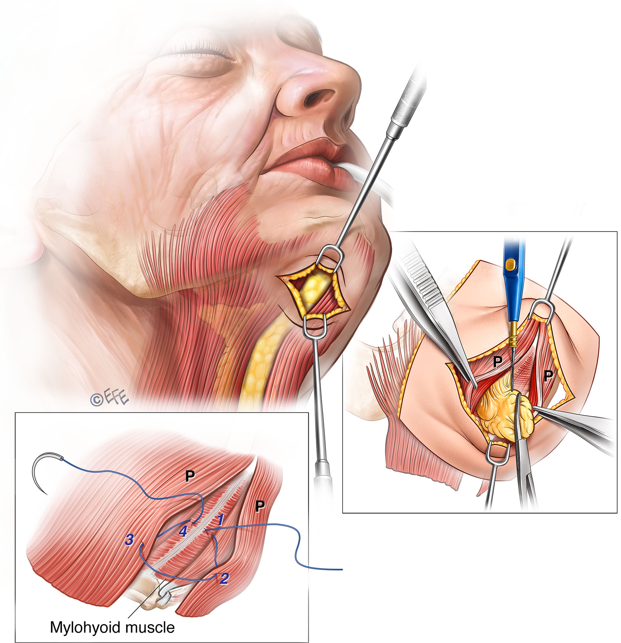 Original.00006534-202504000-00012.F1